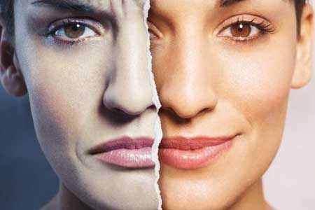تفاوت اختلال دوقطبی نوع یک و دو